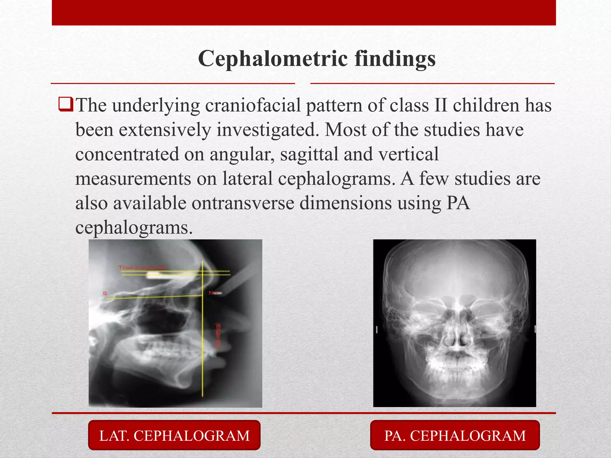 The underlying craniofacial pattern of class II children has
been extensively investigated. Most of the studies have
concentrated on angular, sagittal and vertical
measurements on lateral cephalograms. A few studies are
also available ontransverse dimensions using PA
cephalograms.
Cephalometric findings
PA. CEPHALOGRAMLAT. CEPHALOGRAM
 