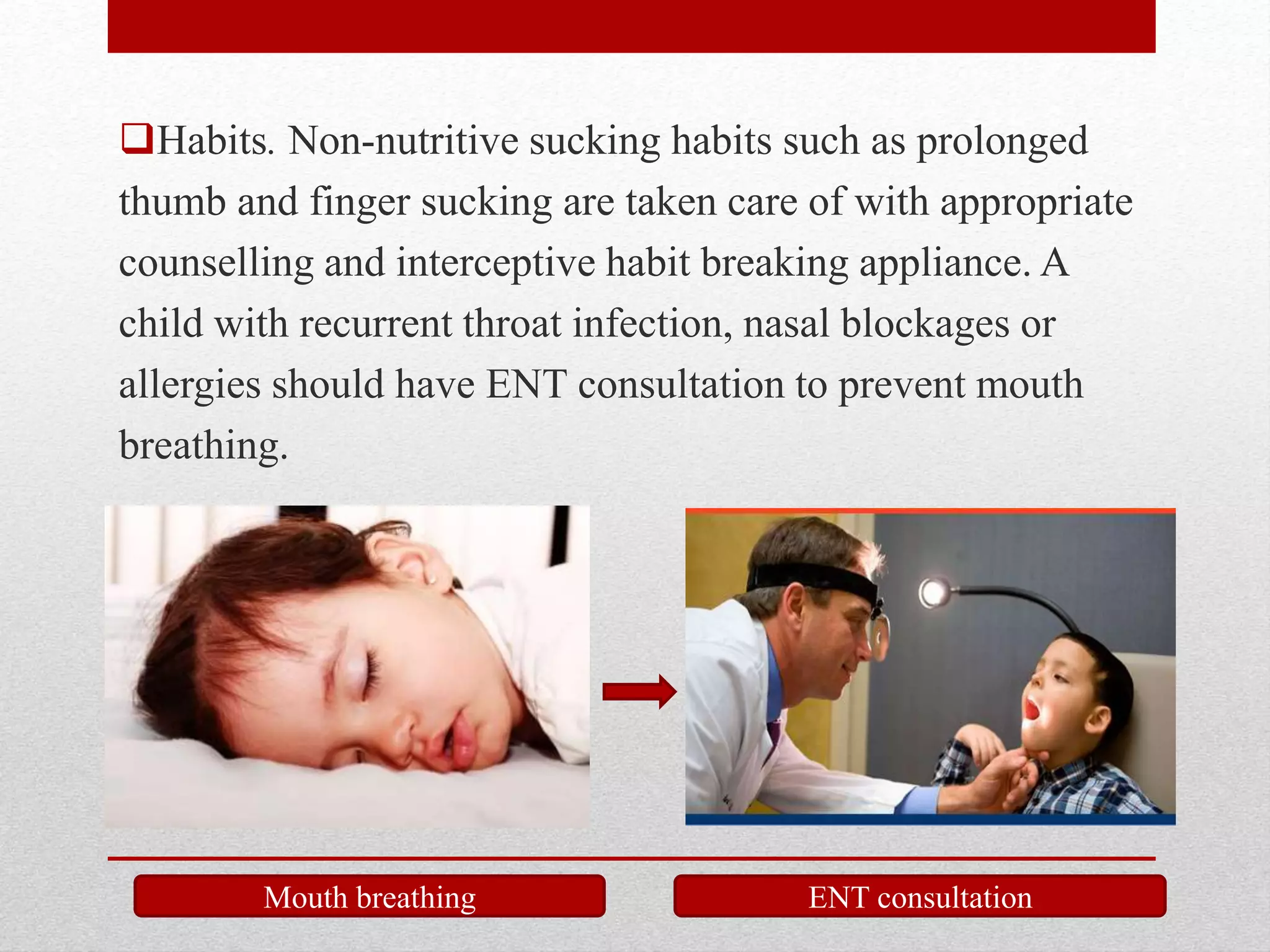 Habits. Non-nutritive sucking habits such as prolonged
thumb and finger sucking are taken care of with appropriate
counselling and interceptive habit breaking appliance. A
child with recurrent throat infection, nasal blockages or
allergies should have ENT consultation to prevent mouth
breathing.
Mouth breathing ENT consultation
 