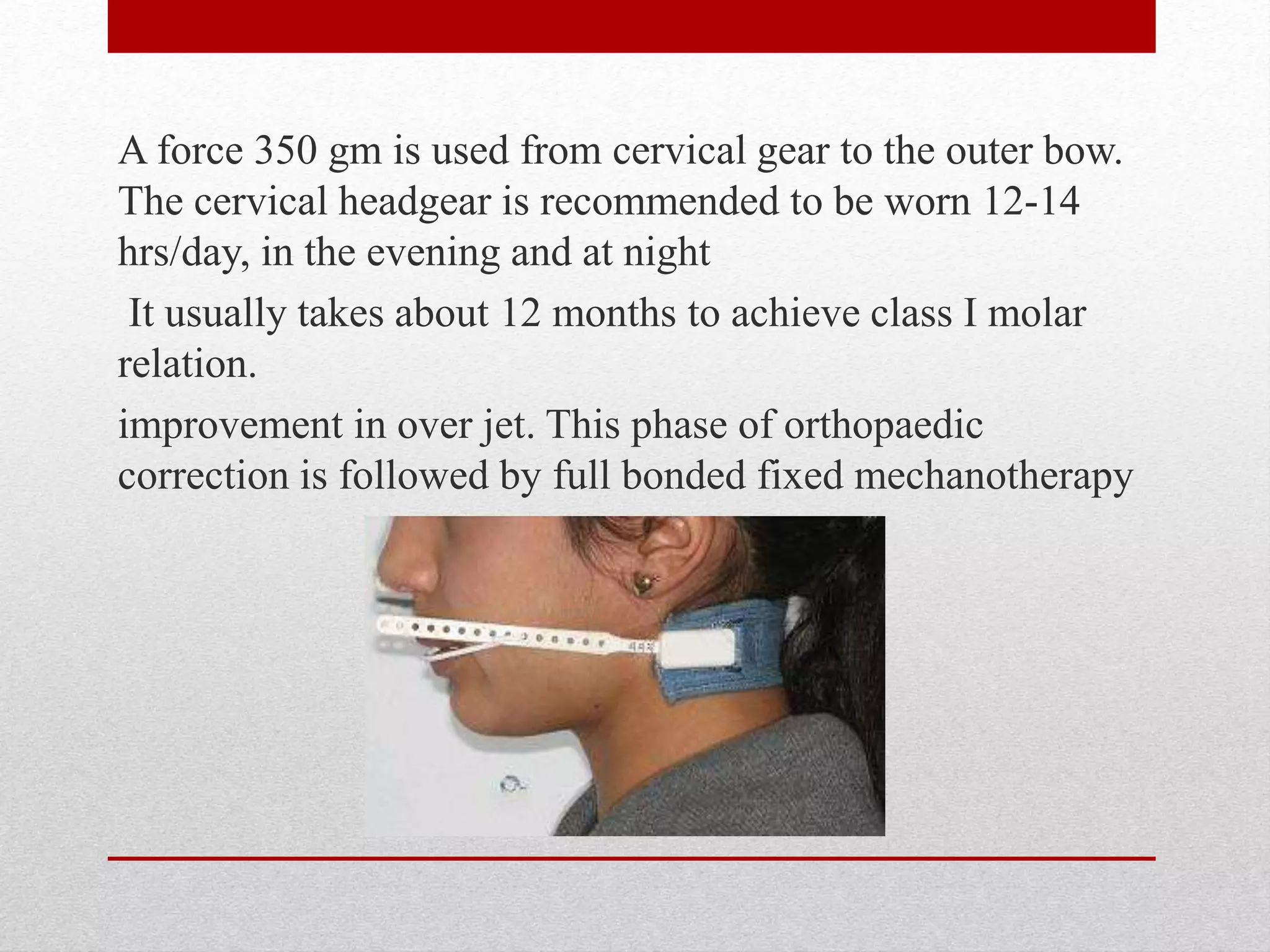 A force 350 gm is used from cervical gear to the outer bow.
The cervical headgear is recommended to be worn 12-14
hrs/day, in the evening and at night
It usually takes about 12 months to achieve class I molar
relation.
improvement in over jet. This phase of orthopaedic
correction is followed by full bonded fixed mechanotherapy
 