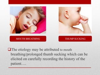 The etiology may be attributed to mouth
breathing/prolonged thumb sucking which can be
elicited on carefully recording the history of the
patient….
THUMP SUCKINGMOUTH BREATHING
 