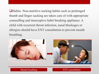 Habits. Non-nutritive sucking habits such as prolonged
thumb and finger sucking are taken care of with appropriate
counselling and interceptive habit breaking appliance. A
child with recurrent throat infection, nasal blockages or
allergies should have ENT consultation to prevent mouth
breathing.
Mouth breathing ENT consultation
 