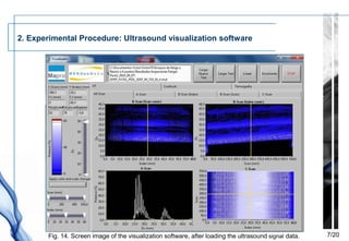 2. Experimental Procedure: Ultrasound visualization software




       Fig. 14. Screen image of the visualization software, after loading the ultrasound signal data.   7/20
 