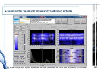 2. Experimental Procedure: Ultrasound visualization software




Fig. 15. Screen image after: digitally aligning the first peak, positioning the cut off lines, and setting a color range.   8/20
 