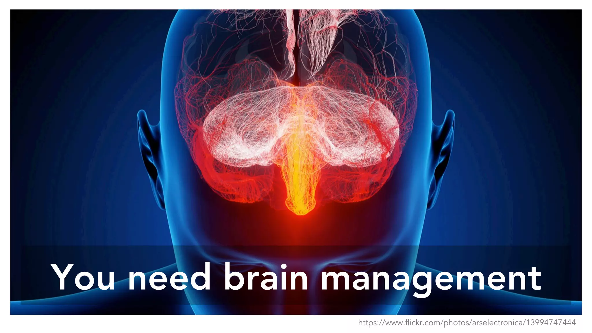 You need brain management
https://www.flickr.com/photos/arselectronica/13994747444
 