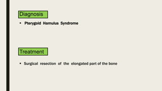PTERYGOID HAMULUS SYNDROME- A CASE REPORT | PPTX