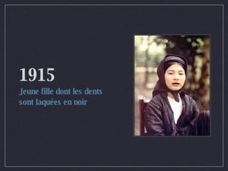 1915 Jeune fille dont les dents sont laquées en noir 