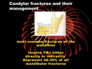 Condylar fractures and their
management
most common fractures of the
mandible.
Involve TMJ either
directly or indirectly
Represent 20-30% of all
mandibular fractures
 