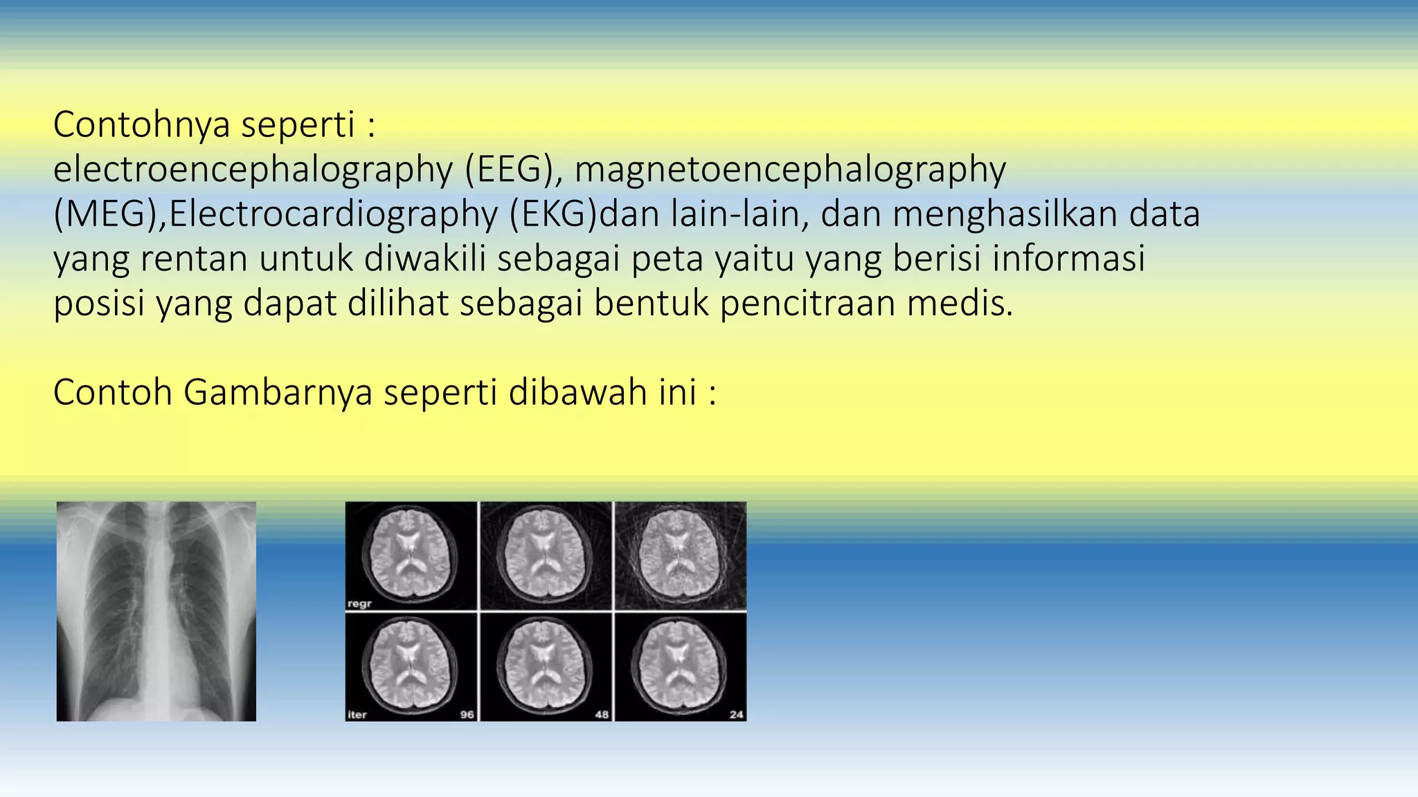Contohnya seperti : 
electroencephalography (EEG), magnetoencephalography 
(MEG),Electrocardiography (EKG)dan lain-lain, dan menghasilkan data 
yang rentan untuk diwakili sebagai peta yaitu yang berisi informasi 
posisi yang dapat dilihat sebagai bentuk pencitraan medis. 
Contoh Gambarnya seperti dibawah ini : 
 