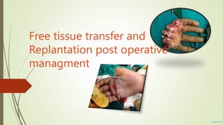 Free tissue transfer and
Replantation post operative
managment
ZoReKh.AlA
 