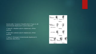 presentation lisfranc INJURY TYPES INVESTIGATION AND MANAGEMENT | PPTX