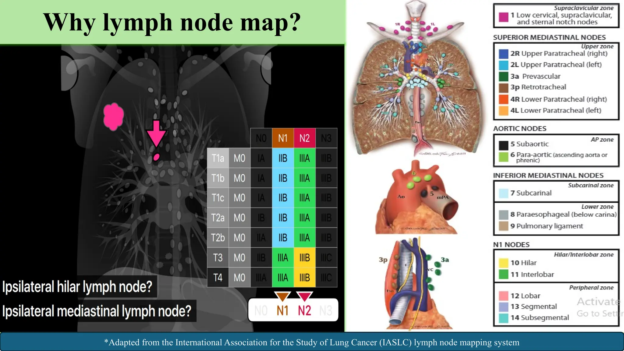 8
Why lymph node map?
*Adapted from the International Association for the Study of Lung Cancer (IASLC) lymph node mapping system
 