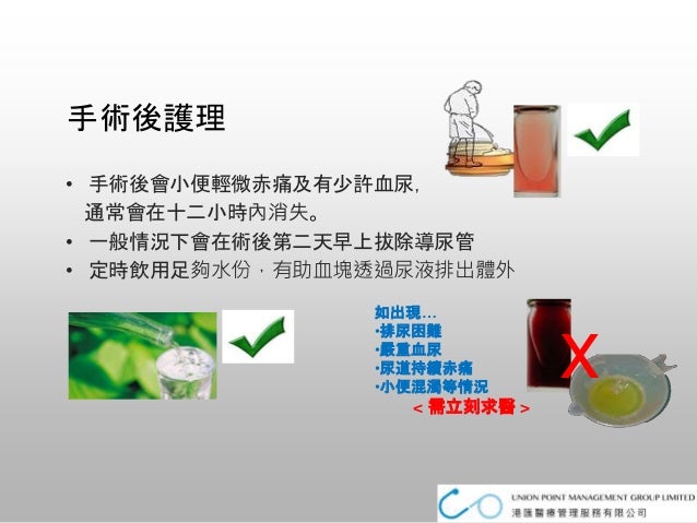 男性泌尿前列腺問題