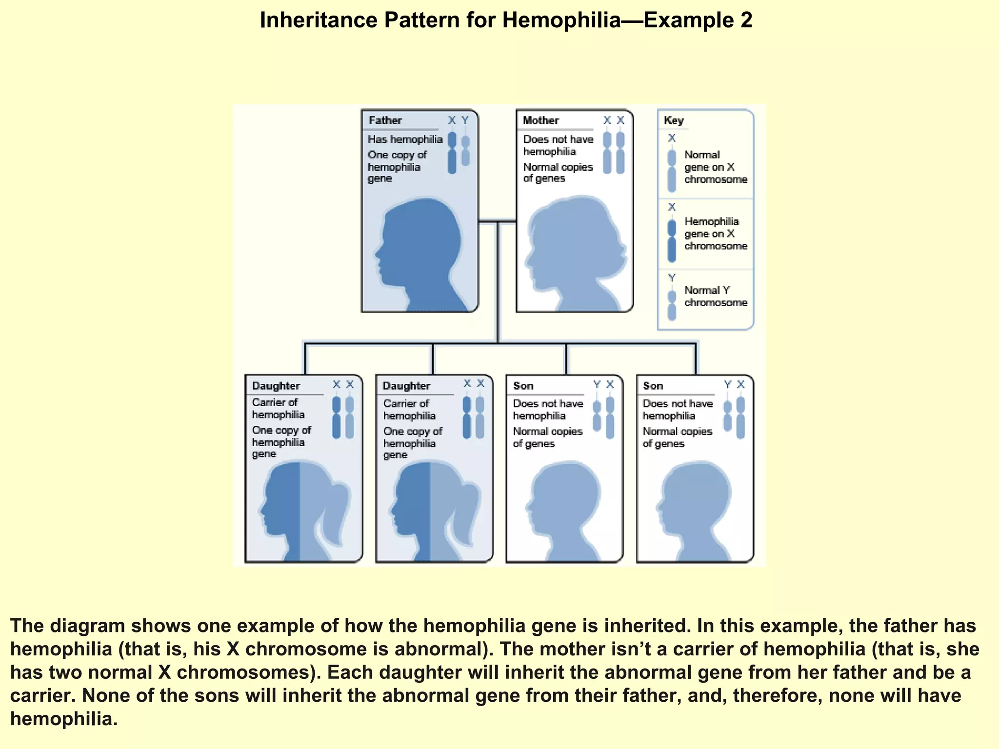Inheritance Pattern for Hemophilia—Example 2  The diagram shows one example of how the hemophilia gene is inherited. In this example, the father has hemophilia (that is, his X chromosome is abnormal). The mother isn’t a carrier of hemophilia (that is, she has two normal X chromosomes). Each daughter will inherit the abnormal gene from her father and be a carrier. None of the sons will inherit the abnormal gene from their father, and, therefore, none will have hemophilia.  