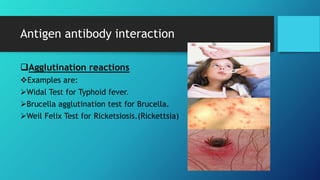 Antigen antibody interaction
Agglutination reactions
Examples are:
Widal Test for Typhoid fever.
Brucella agglutination test for Brucella.
Weil Felix Test for Ricketsiosis.(Rickettsia)
 