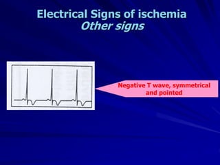 Electrical Signs of ischemia
Other signs
Negative T wave, symmetrical
and pointed
 