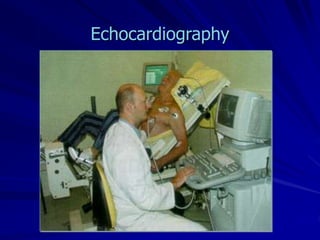Echocardiography
 
