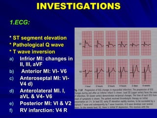 INVESTIGATIONS
1.ECG:
* ST segment elevation
* Pathological Q wave
* T wave inversion
a) Infrior MI: changes in
II, III, aVF
b) Anterior MI: VI- V6
c) Anteroseptal MI: VI-
V4 d)
d) Anterolateral MI. I,
aVL & V4- V6
e) Posterior MI: VI & V2
f) RV infarction: V4 R
 