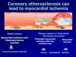 Stable plaque Plaque rupture or fissuration
Thrombus formation
Coronary atherosclerosis can
lead to myocardial ischemia
Myocardial ischemia with
Moderate/severe
exertion
Chronic Ischemic Disease
Myocardial
necrosis
Prolonged myocardial
ischemia with less
exertion/rest
Acute Ischaemic Events
 