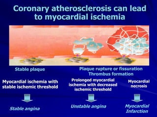 Stable angina
Unstable angina Myocardial
Infarction
Stable plaque Plaque rupture or fissuration
Thrombus formation
Myocardial ischemia with
stable ischemic threshold
Myocardial
necrosis
Prolonged myocardial
ischemia with decreased
ischemic threshold
Coronary atherosclerosis can lead
to myocardial ischemia
 