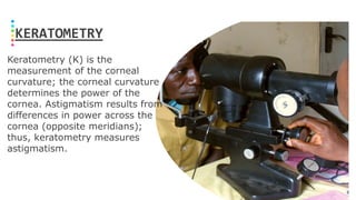 KERATOMETRY
Keratometry (K) is the
measurement of the corneal
curvature; the corneal curvature
determines the power of the
cornea. Astigmatism results from
differences in power across the
cornea (opposite meridians);
thus, keratometry measures
astigmatism.
 