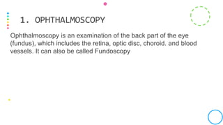 Ophthalmoscopy is an examination of the back part of the eye
(fundus), which includes the retina, optic disc, choroid. and blood
vessels. It can also be called Fundoscopy
1. OPHTHALMOSCOPY
 