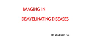 IMAGING IN
DEMYELINATINGDISEASES
Dr. Shubham Rai
 