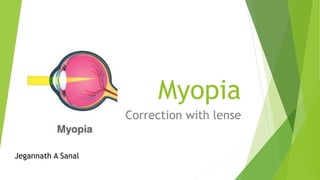 Myopia
Correction with lense
Jegannath A Sanal
 