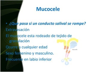 Mucocele¿Que pasa si un conducto salival se rompe?Extravasación El mucocele esta rodeado de tejido de granulaciónOcurre a cualquier edadSexo femenino y masculino.Frecuente en labio inferior