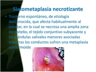 SialometaplasianecrotizanteTrastorno espontáneo, de etiología desconocida, que afecta habitualmente al  paladar, en la cual se necrosa una amplia zona de epitelio, el tejido conjuntivo subyacente y las glándulas salivales menores asociadas mientras los conductos sufren una metaplasiaepidermoide.
