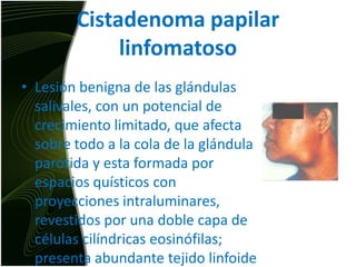 Cistadenoma papilar linfomatosoLesión benigna de las glándulas salivales, con un potencial de crecimiento limitado, que afecta sobre todo a la cola de la glándula parótida y esta formada por espacios quísticos con proyecciones intraluminares, revestidos por una doble capa de células cilíndricas eosinófilas; presenta abundante tejido linfoide en el tejido conjuntivo subyacente.