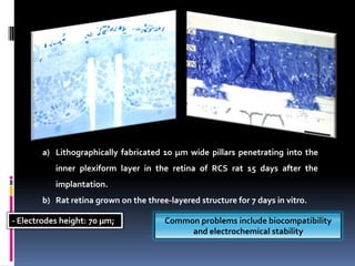 Effect of cellular migration !!Two basic geometries of sub-retinal implants presented: perforated membranes and protruding electrode arraysPhotodiodes convert light into pulsed electriccurrentElectrodes must inject enough charge to stimulate nerve cells, within electrochemically safe voltage limits