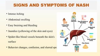 SIGNS AND SYMPTOMS OF NASH
• Intense itching
• Abdominal swelling
• Easy bruising and bleeding
• Jaundice (yellowing of the skin and eyes)
• Spider-like blood vessels beneath the skin's
surface
• Behavior changes, confusion, and slurred speech.
 