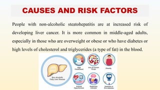 CAUSES AND RISK FACTORS
People with non-alcoholic steatohepatitis are at increased risk of
developing liver cancer. It is more common in middle-aged adults,
especially in those who are overweight or obese or who have diabetes or
high levels of cholesterol and triglycerides (a type of fat) in the blood.
 