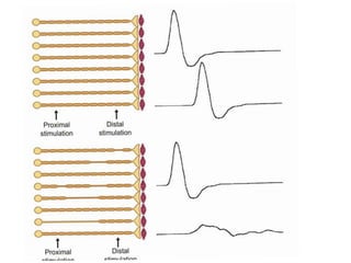 Basic overview of nerve conduction studies