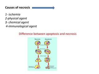 Causes of necrosis
1- ischemia
2-physical agent
3- chemical agent
4-immunological agent
Difference between apoptosis and necrosis
 
