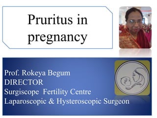 Prof. Rokeya Begum
DIRECTOR
Surgiscope Fertility Centre
Laparoscopic & Hysteroscopic Surgeon
Pruritus in
pregnancy
 