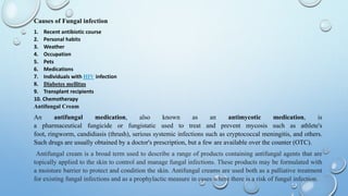 ABOUT ANTIFUNGAL CREAM | PPT