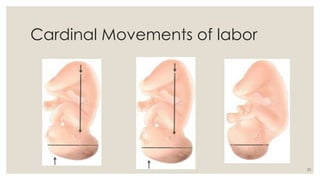 23
Cardinal Movements of labor
 