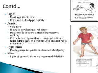 Presentation of cerebral palsy | PPTX