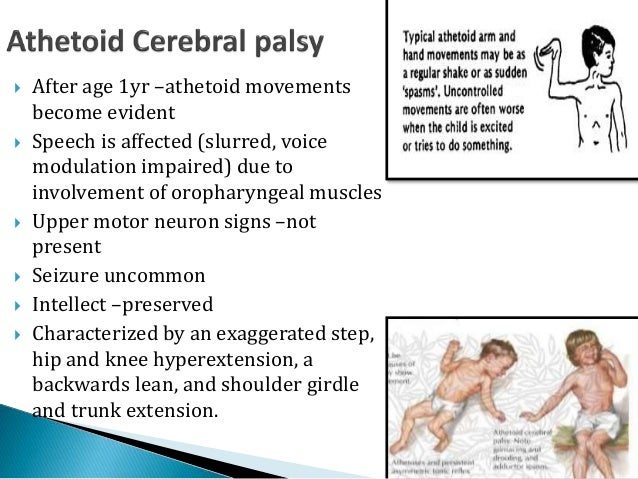 presentation of cerebral palsy athetoid cerebral palsy