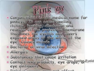 Presentation of eye ths