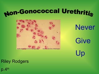 Riley Rodgers  p.4 th   Never Give  Up   Non-Gonococcal Urethritis 