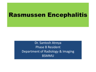 Rasmussen Encephalitis
Dr. Santosh Atreya
Phase B Resident
Department of Radiology & Imaging
BSMMU
 