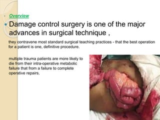 • Overview
 Damage control surgery is one of the major
advances in surgical technique ,
they contravene most standard surgical teaching practices - that the best operation
for a patient is one, definitive procedure.
multiple trauma patients are more likely to
die from their intra-operative metabolic
failure that from a failure to complete
operative repairs.
 