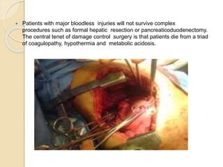  Patients with major bloodless injuries will not survive complex
procedures such as formal hepatic resection or pancreaticoduodenectomy.
The central tenet of damage control surgery is that patients die from a triad
of coagulopathy, hypothermia and metabolic acidosis.
 