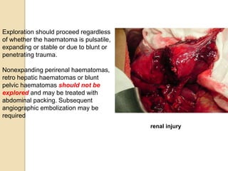 Exploration should proceed regardless
of whether the haematoma is pulsatile,
expanding or stable or due to blunt or
penetrating trauma.
Nonexpanding perirenal haematomas,
retro hepatic haematomas or blunt
pelvic haematomas should not be
explored and may be treated with
abdominal packing. Subsequent
angiographic embolization may be
required
renal injury
 