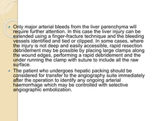  Only major arterial bleeds from the liver parenchyma will
require further attention. In this case the liver injury can be
extended using a finger-fracture technique and the bleeding
vessels identified and tied or clipped. In some cases, where
the injury is not deep and easily accessible, rapid resection
debridement may be possible by placing large clamps along
the wound edges, performing a rapid debridement and the
under running the clamp with suture to include all the raw
surface.
 The patient who undergoes hepatic packing should be
considered for transfer to the angiography suite immediately
after the operation to identify any ongoing arterial
haemorrhage which may be controlled with selective
angiographic embolization.
 