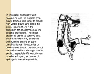 In this case, especially with
colonic injuries, or multiple small
bowel lesions, it is wiser to resect
non-viable bowel and close the
ends, leaving them in the
abdomen for anastomosis at the
second procedure. The linear
stapler is useful to achieve this,
but bowel ends may be closed
with running suture or even
umbilical tapes. Ileostomies or
colostomies should preferably not
be performed in a damage control
setting, especially if the abdomen
is to be left open, as control of
spillage is almost impossible.
 