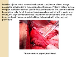 Massive injuries to the pancreaticoduodenal complex are almost always
associated with injuries to the surrounding structures. Patients will not survive
complex operations such as pancreaticoduodenectomy. The pancreas should
be debrided only. Small duodenal injuries can be repaired with a single layer
suture, but large duodenal injuries should be debrided and the ends closed
temporarily with suture or umbilical tape to be dealt with at the second
procedure.
Gunshot wound to pancreatic head
 