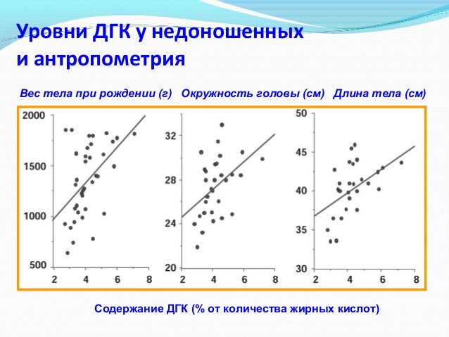 Что такое чокер и с чем его носят Что такое чокер и с чем его носят